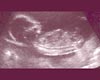 Sally Smith's baby scan thumbnail